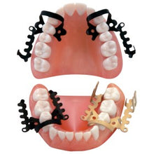 Load image into Gallery viewer, Hallerclamp (full set)