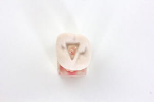 3 MTA and Bioceramic training molar teeth